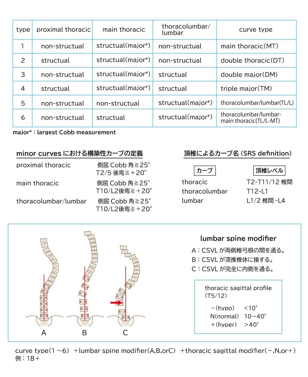 Lenkeによる側弯の新しい分類