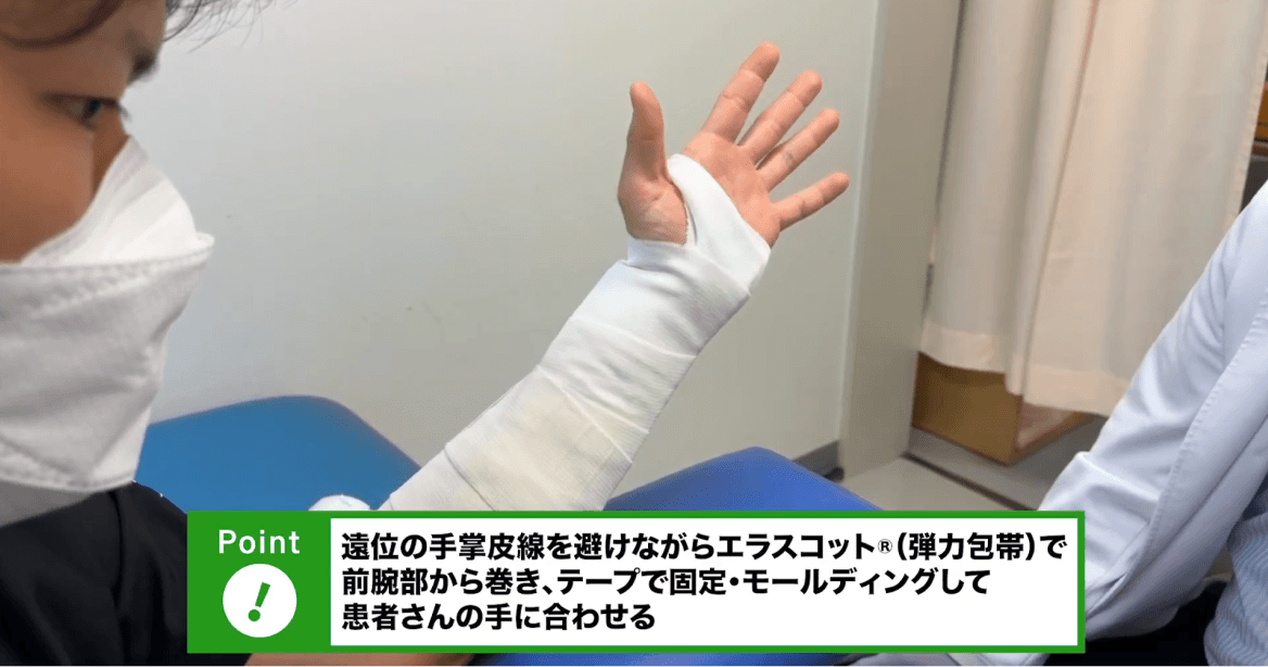 前腕シーネ