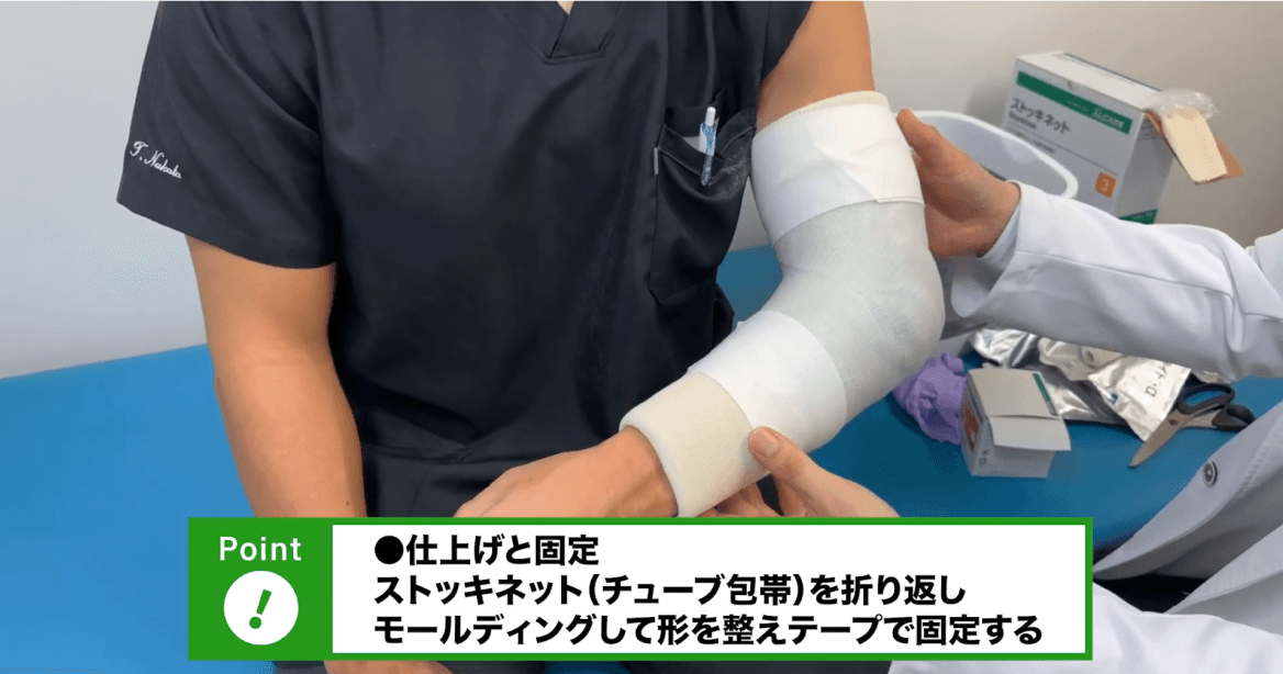 上肢キャスト