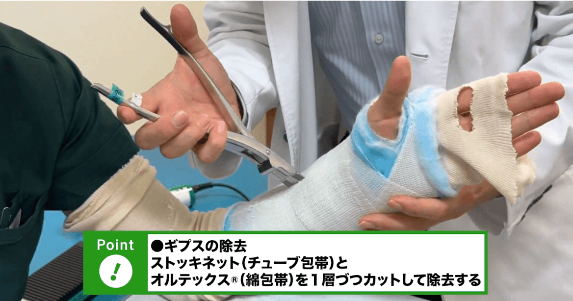 前腕キャストカット