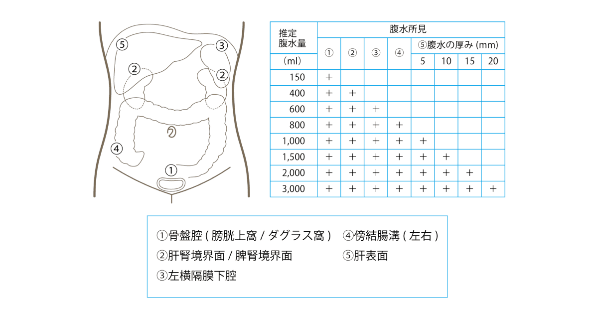 Echo free spaces による複水・出血量の推定